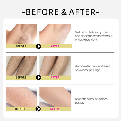 Cyperus Rotundus Oil for Hair Reduction